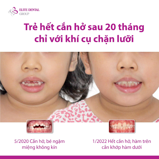 thoi-quen-mut-tay-03