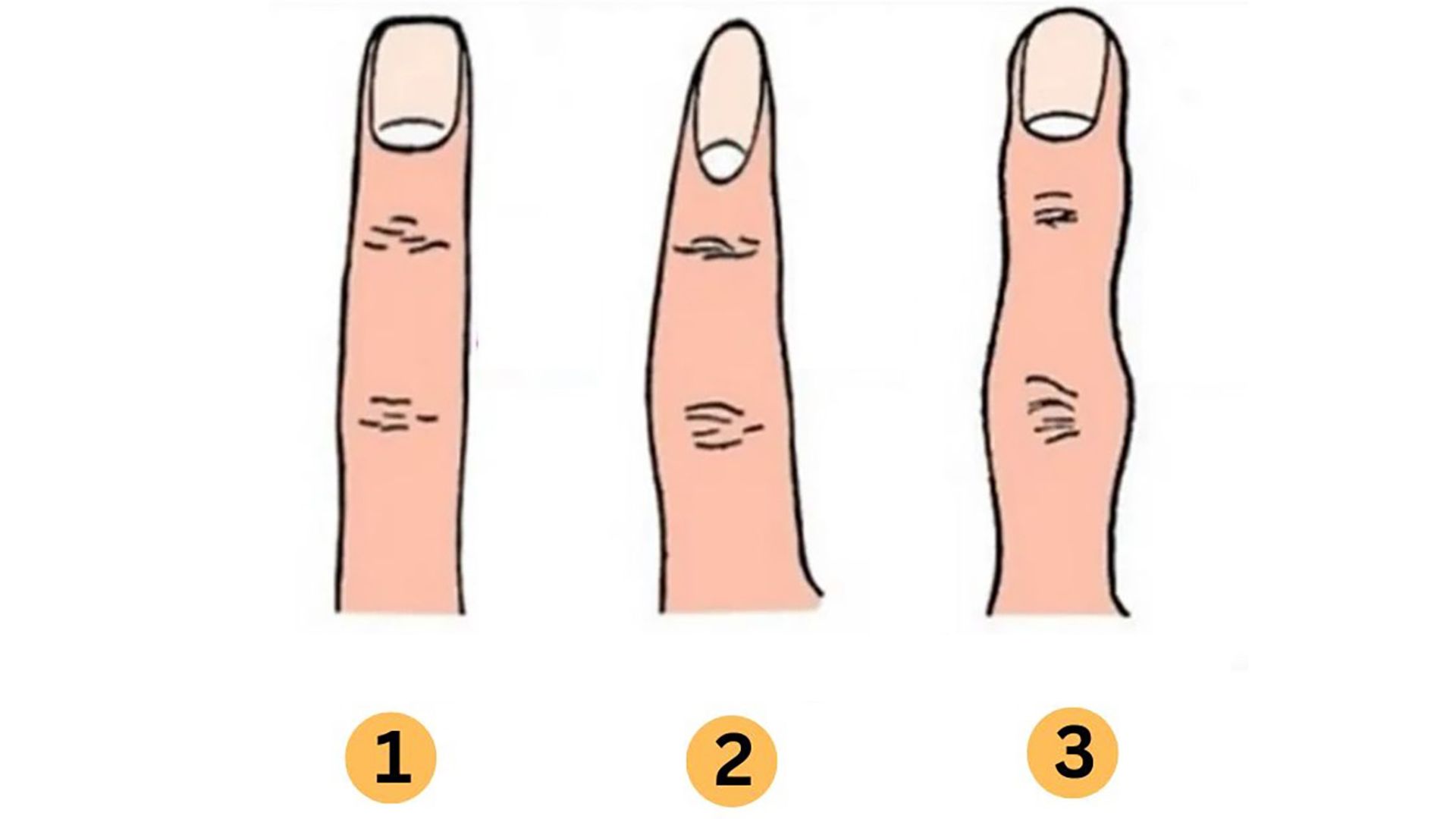 trắc nghiệm hình ảnh ngón tay