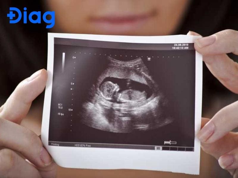 Hình ảnh siêu âm bé gái, bé trai 12 tuần tuổi