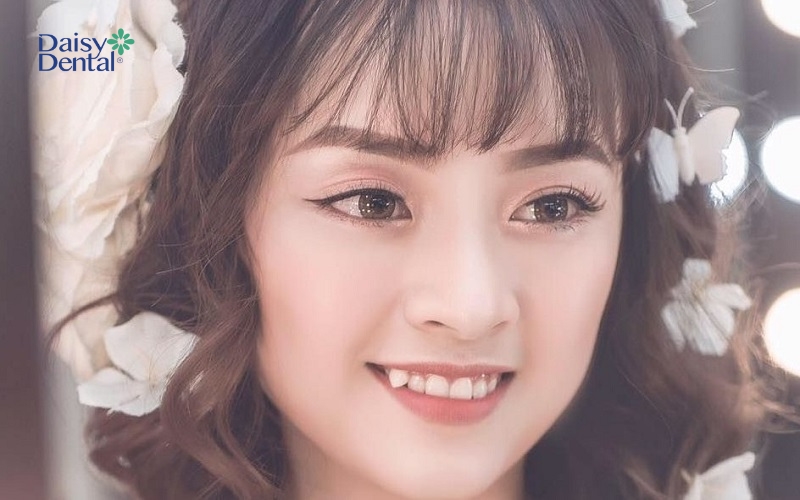 Một chiếc nhan sắc đẹp nhẹ nhàng nhờ nụ cười có răng khểnh