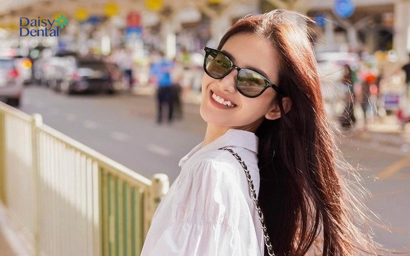 Nụ cười răng khểnh xinh xắn cho bạn gái thêm tự tin tỏa sáng