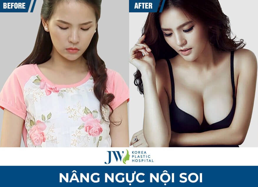 nang-nguc-noi-soi-jw