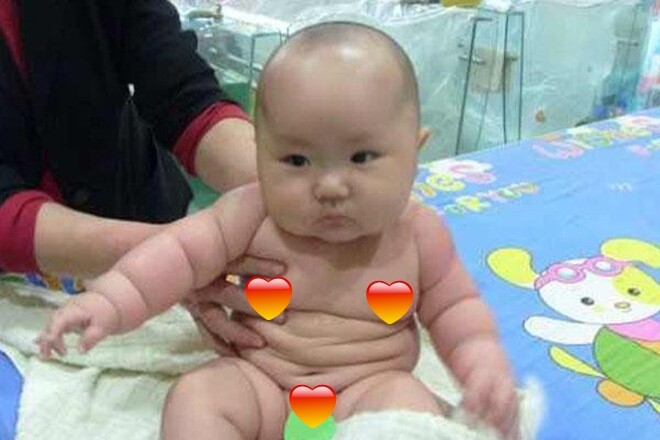 Trong mắt các bà, trẻ càng béo càng khỏe mạnh. Ảnh minh họa
