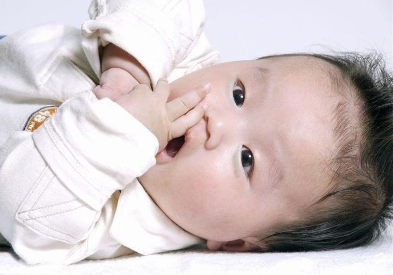 Trẻ bị thâm quầng mắt là bệnh gì? Nguyên nhân, cách điều trị