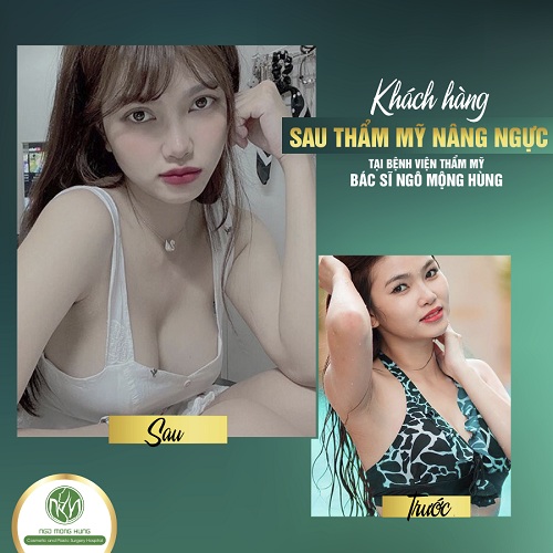 Bạn đã biết địa chỉ thẩm mỹ nâng ngực nào CHẤT LƯỢNG - UY TÍN cho mình chưa?