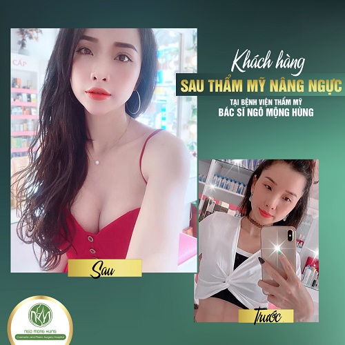 Bạn đã biết địa chỉ thẩm mỹ nâng ngực nào CHẤT LƯỢNG - UY TÍN cho mình chưa?