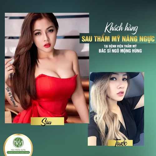 Bạn đã biết địa chỉ thẩm mỹ nâng ngực nào CHẤT LƯỢNG - UY TÍN cho mình chưa?