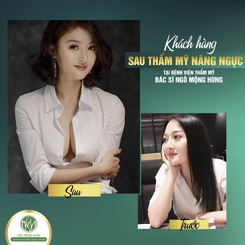 Bạn đã biết địa chỉ thẩm mỹ nâng ngực nào CHẤT LƯỢNG - UY TÍN cho mình chưa?