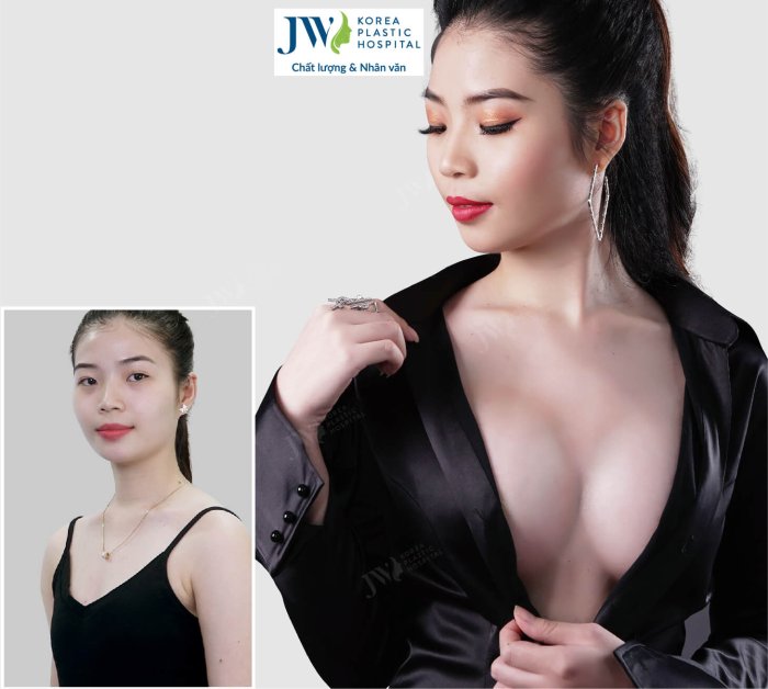 nang-nguc-jw-3