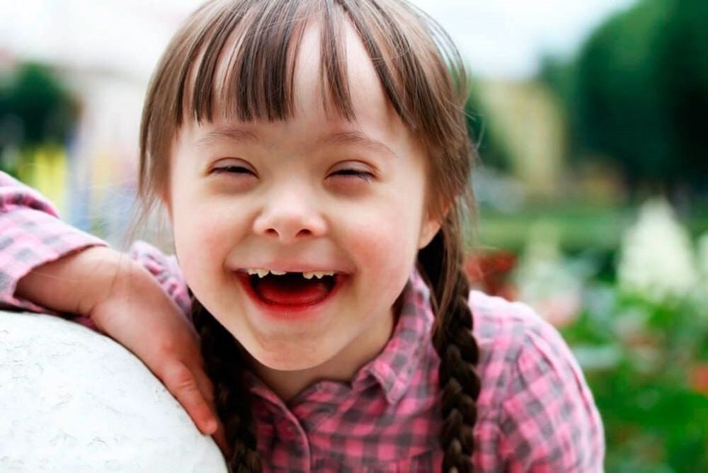 Bé gái mắc bệnh Down sẽ gây ra sự chậm phát triển ở bé gái