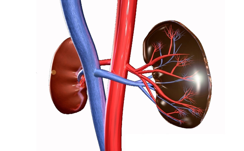 Bệnh thận gây hạ natri máu