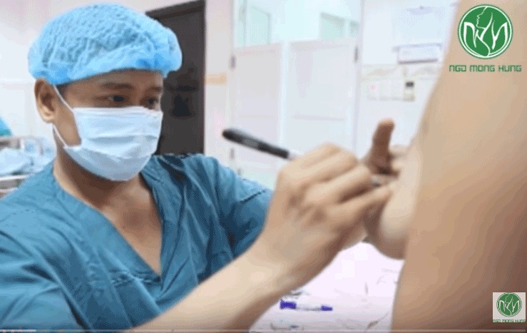 Thu nhỏ đầu vú