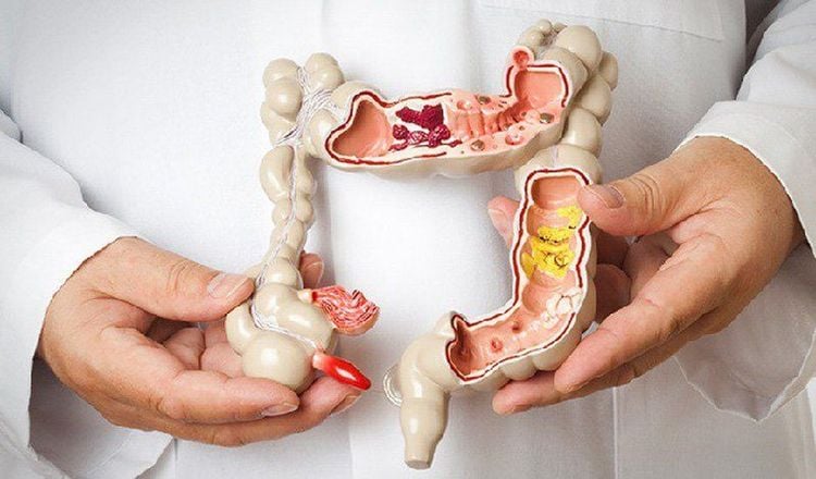 Nước có vai trò hỗ trợ thúc đẩy tiêu hóa