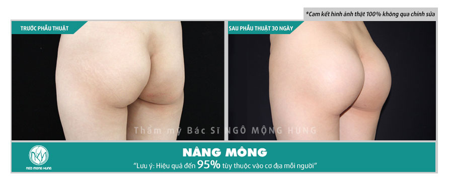 Quần nâng mông chảy xệ