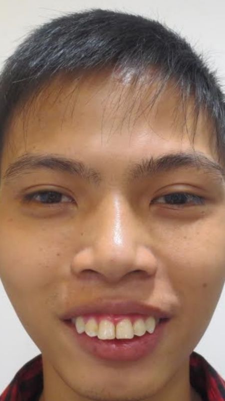 anh-trai-xau-13