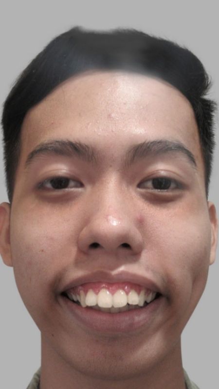 anh-trai-xau-15