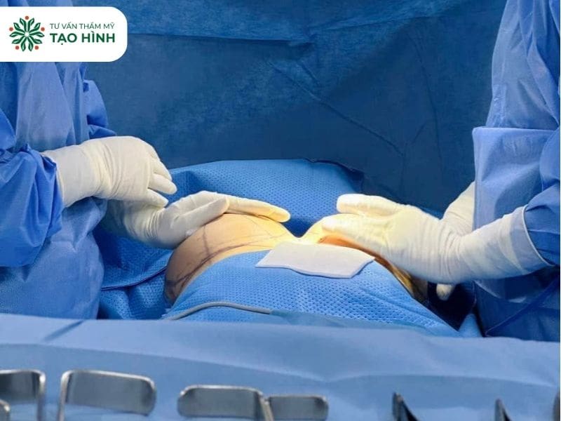 Nâng ngực size to ảnh hưởng tới vòng 1 ra sao? Giải đáp từ bác sĩ