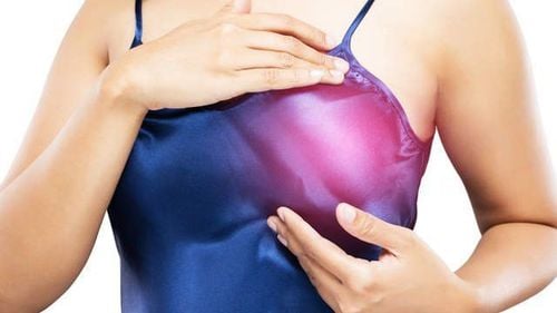 Nếu chụp nhũ ảnh 2 lần mà vẫn nghi ngờ ung thư, bác sĩ có thể chỉ định bệnh nhân sinh thiết vú để khẳng định chẩn đoán