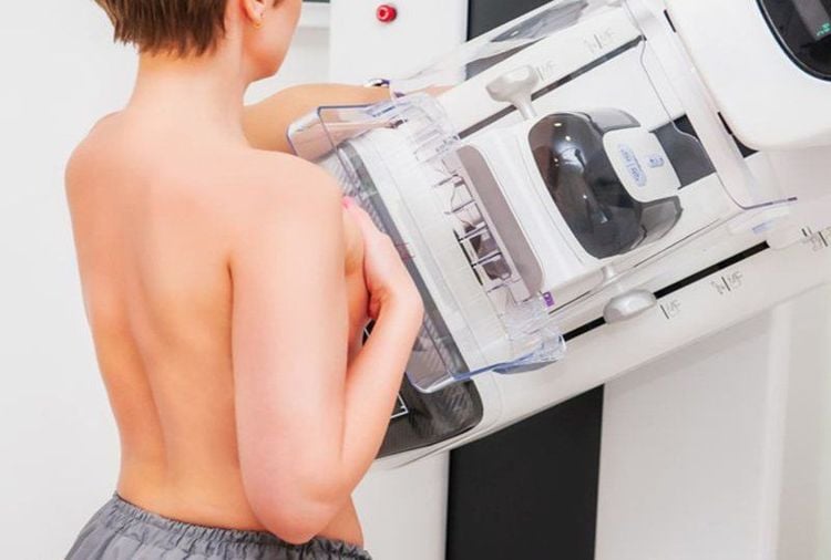 Chụp nhũ ảnh giúp chẩn đoán nguyên nhân tự nhiên vú tiết sữa