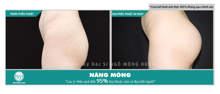 Quần độn mông mặc bikini