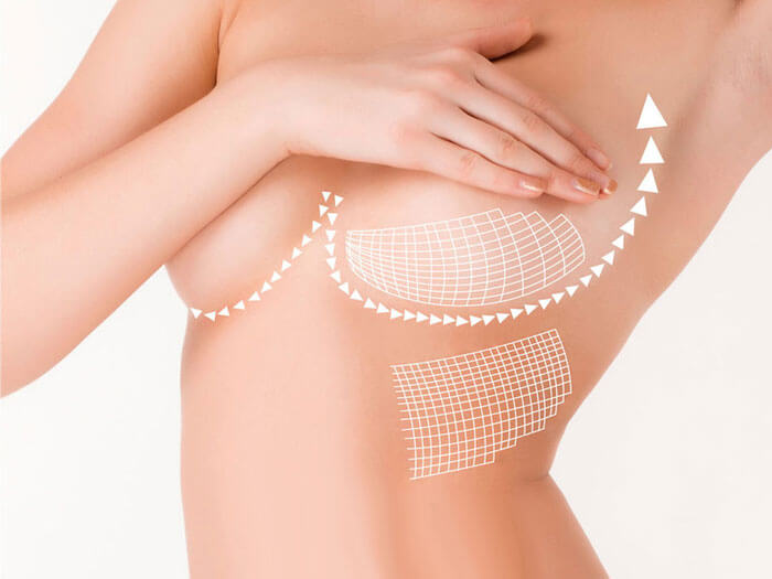 Bóp ngực nhiều có xệ không? Giải đáp từ chuyên gia