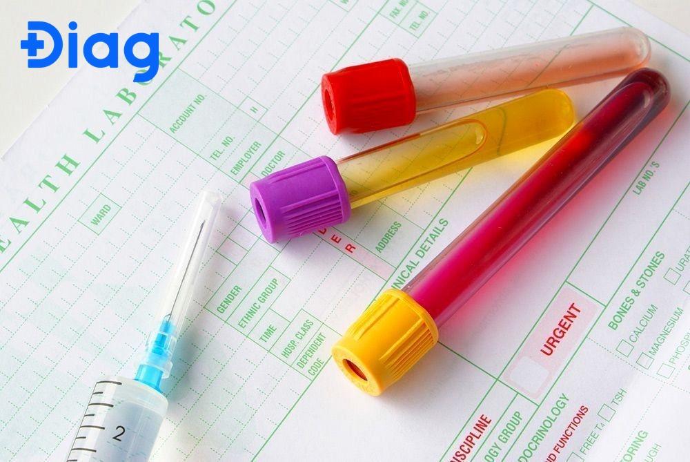 Khoảng tham chiếu trong xét nghiệm máu có ý nghĩa gì?