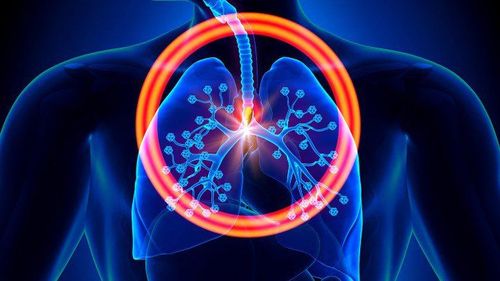 Đau tức ngực bên phải kèm theo khó thở có thể do nguyên nhân ung thư phổi