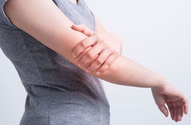 TOS thần kinh phổ biến hơn ở phụ nữ