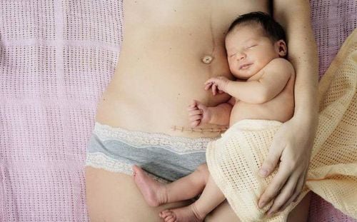 Sinh mổ có thể có tác dụng phụ hay tai biến có thể ảnh hưởng đến tính mạng
