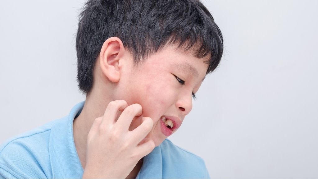 Xét nghiệm sán chó bao nhiêu tiền? Phòng bệnh ra sao? 2