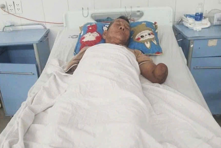 Tình trạng sức khỏe cụ ông sau khi kẹp con rắn hổ mang cắn mình về nhà
