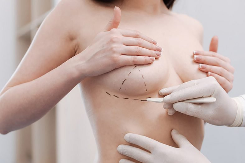 Tốn hàng trăm triệu đồng nâng ngực, cô gái trẻ vẫn phải mặc áo kín mít che ngực lỗi