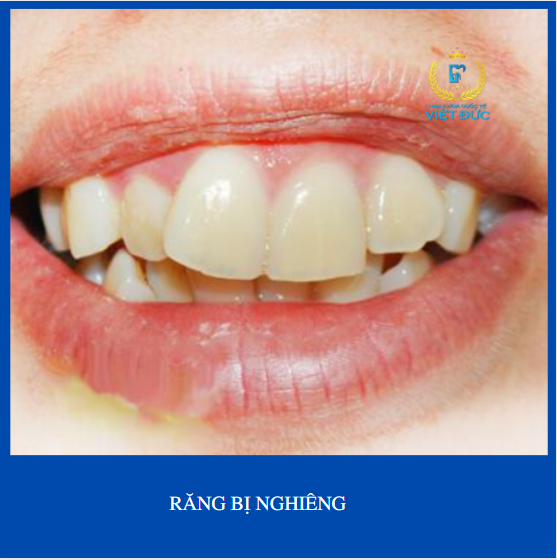 HỆ THỐNG NHA KHOA UY TÍN TẠI VIỆT NAM