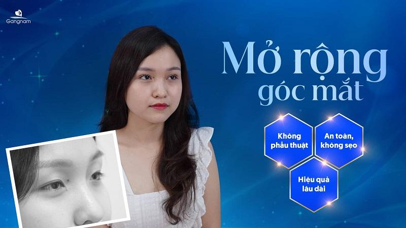 Mở rộng góc mắt