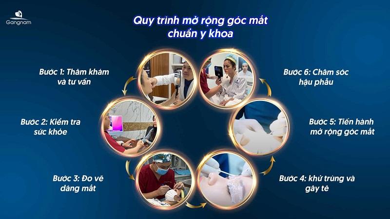 Mở rộng góc mắt