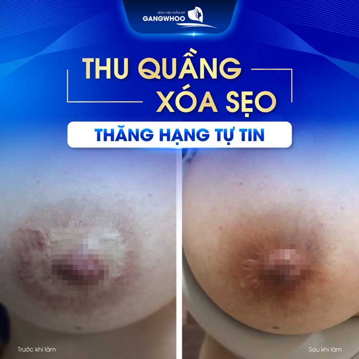 thu quang vu