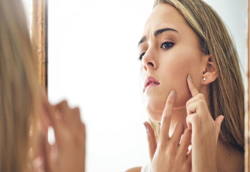 Rối loạn nội tiết tố khiến da đậm màu hơn